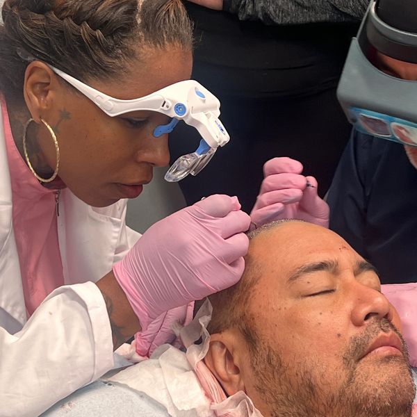 Harvesting the follicular units