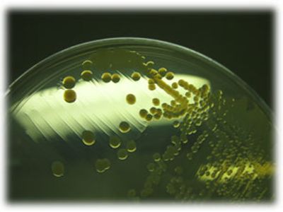 Bacteria Control in Carwash Reclaim