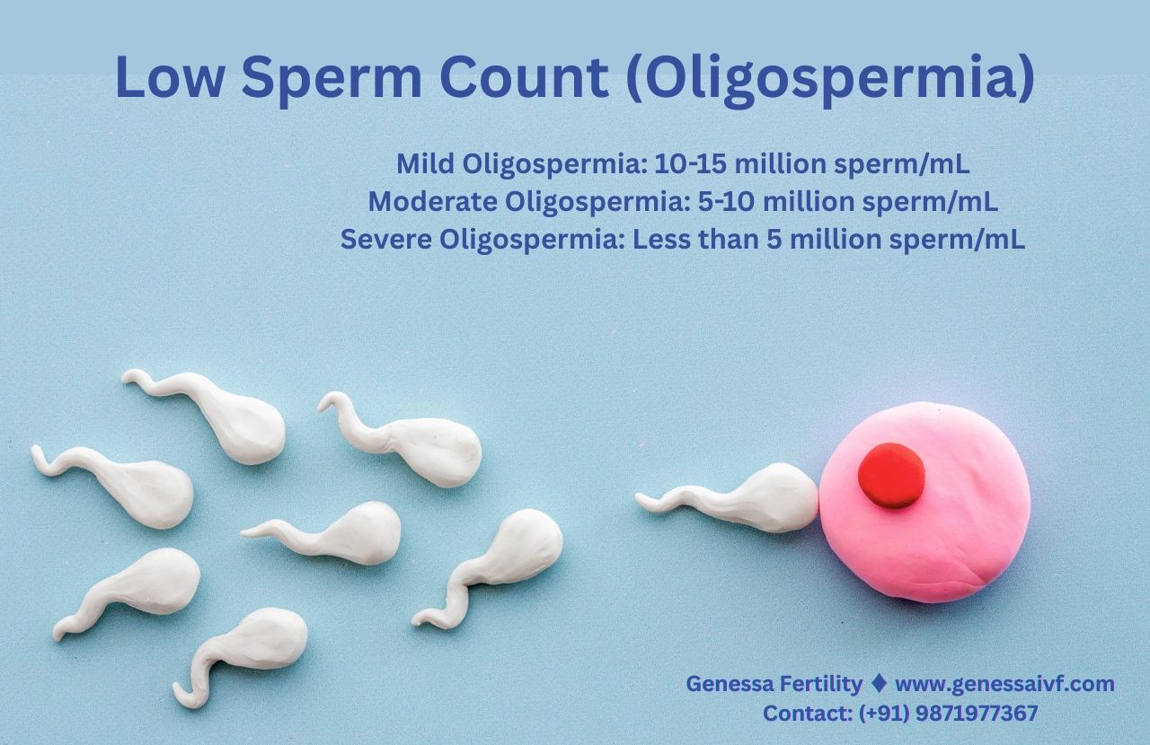 Low Sperm Count - Causes and Treatment