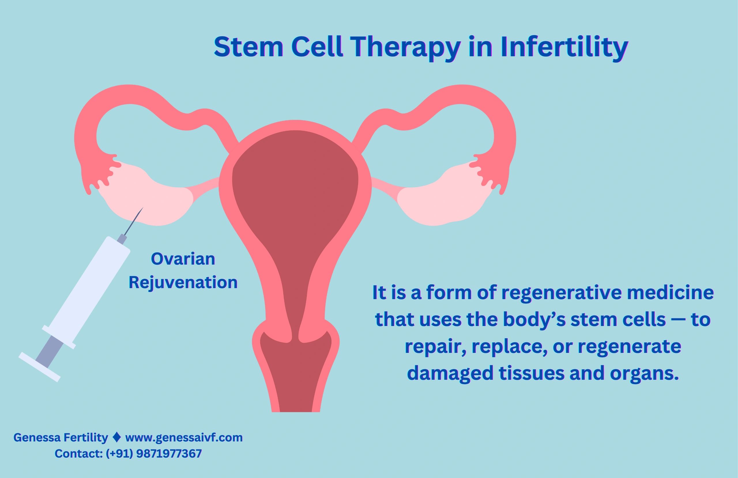 Stem Cell Therapy in Infertility
