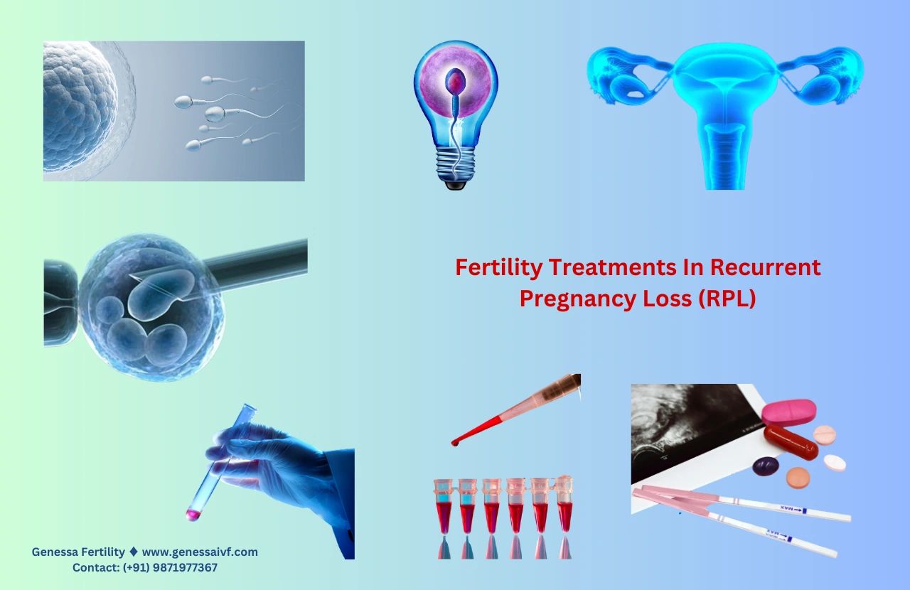 Recurrent Pregnancy Loss (RPL) and Fertility Treatments