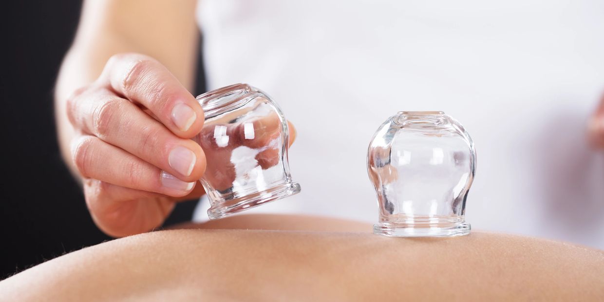 cupping