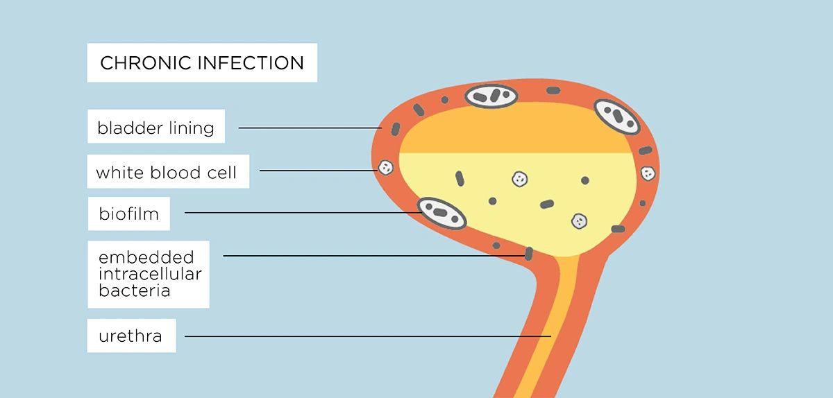 Can Mold Toxicity Cause IC & Urinary Symptoms? Yes! - Interstitial