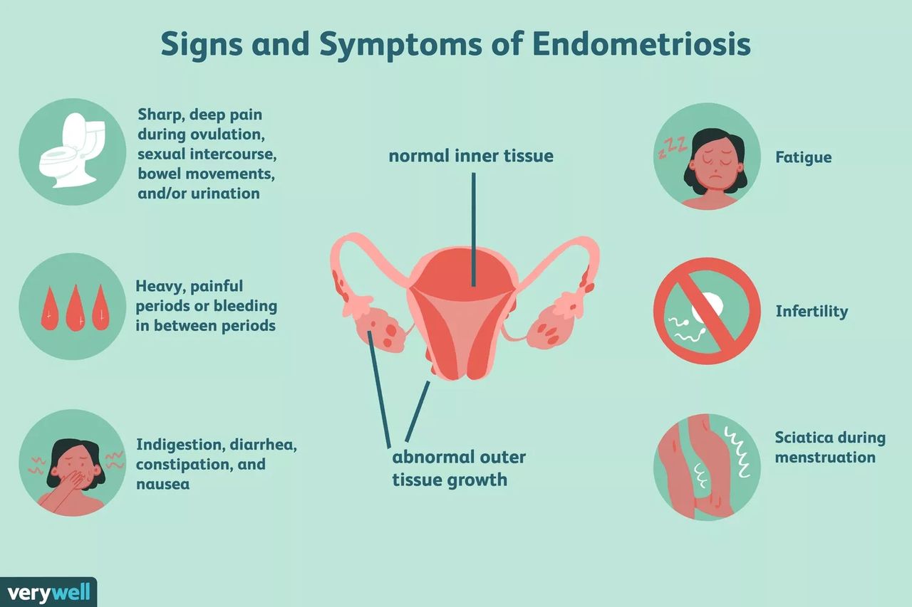 Can Mold Toxicity Cause IC & Urinary Symptoms? Yes! - Interstitial