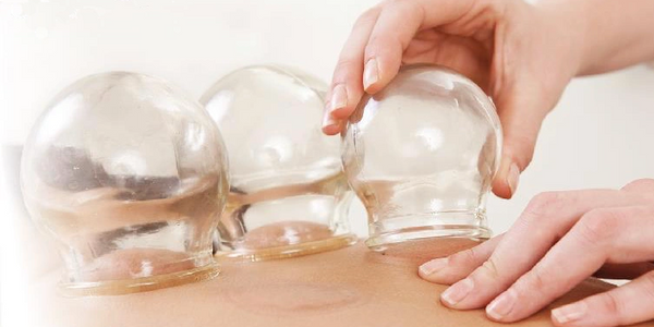 Cupping treatment for relax muscle and improve immune system 
