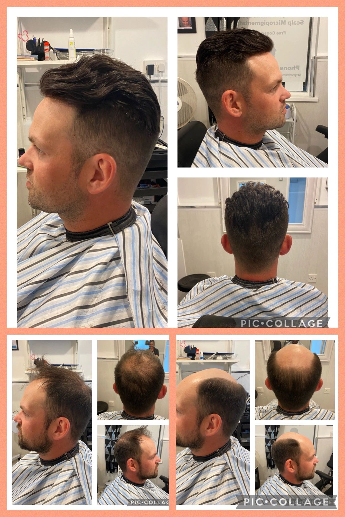 Men’s hair replacement systems and toupees for sale