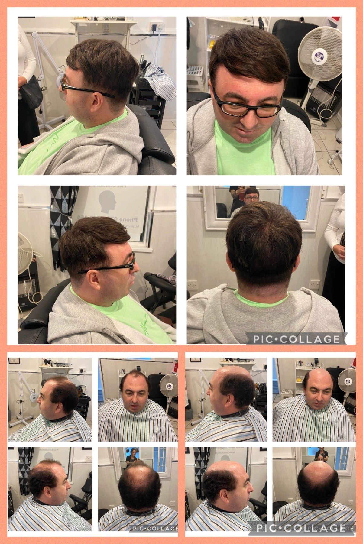 Men’s non surgical hair replacement systems and toupee supply and fitting
