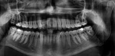 Digital panoramic. . . lots of information with minimal radiation