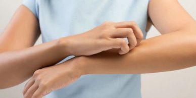 Someone scratching their arm