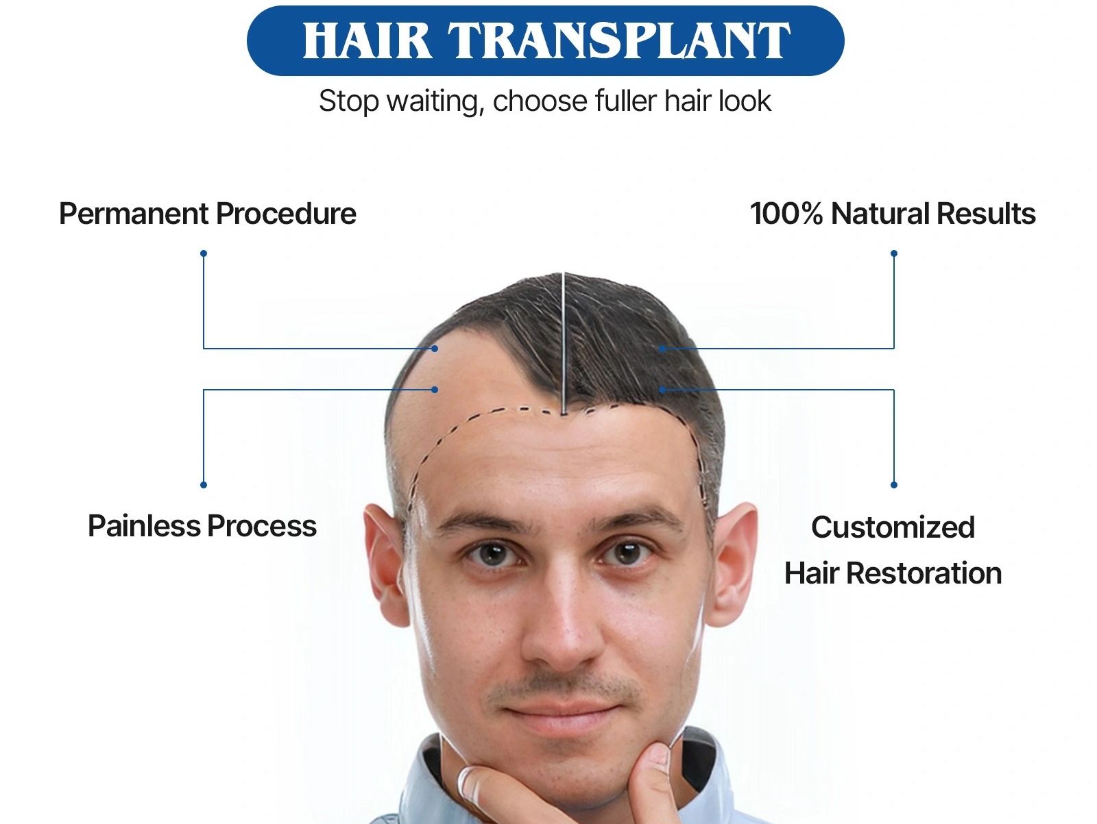 Best Hair Transplant center in Nepal. 
#Hairtransplant #Bharatpur #Chitwan #Hairtransplantsurgeon