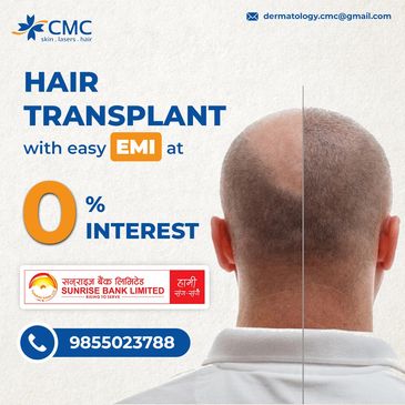 Hair Transplant with EMI  / Sunrise Bank