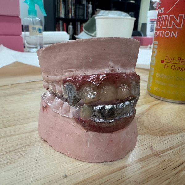 A dental mold with discolored and decayed teeth on a wooden surface.