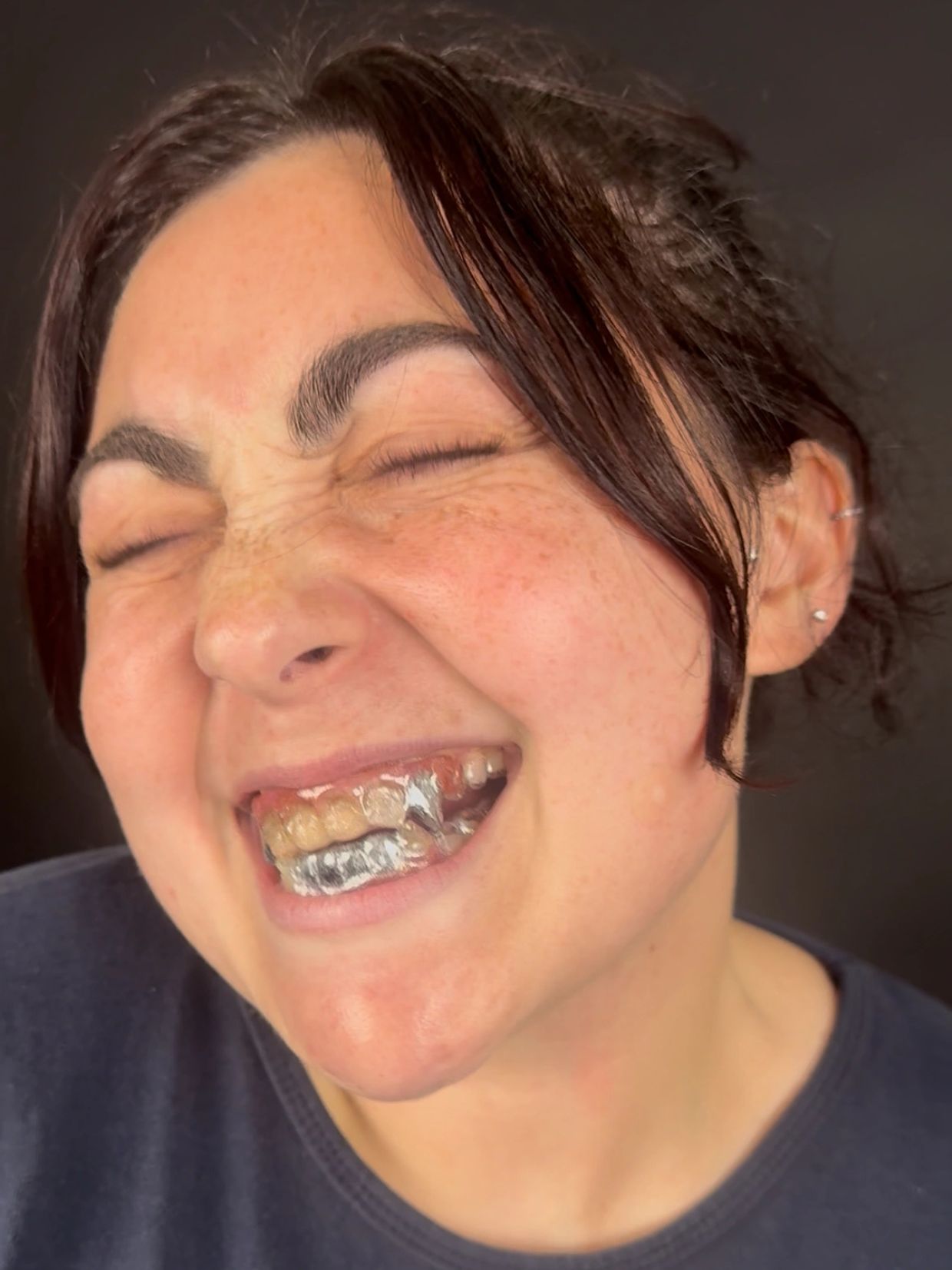 Person smiling with eyes closed, wearing a shiny metallic mouthguard.
