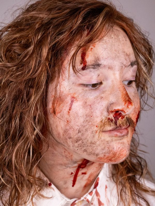 Close-up of a person with facial injuries and blood.