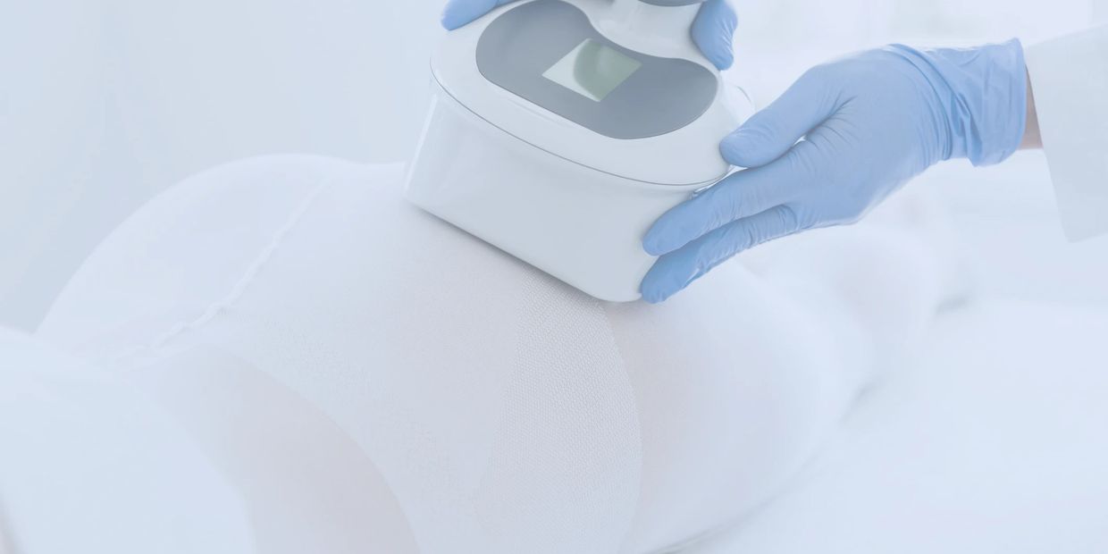 Cryo sculpting at wellness spa Wauconda, a woman having fat frozen off her buttocks