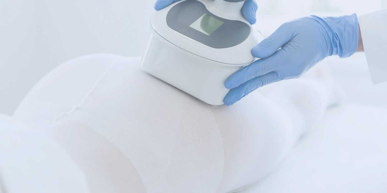 Cryo sculpting at wellness spa Wauconda, a woman having fat frozen off her buttocks