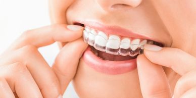 woman putting in invisalign on her teeth to straighten them out