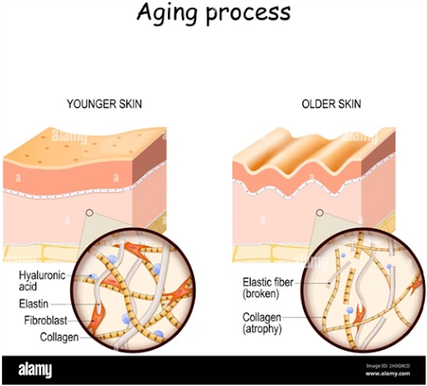 Aging skin diagram
