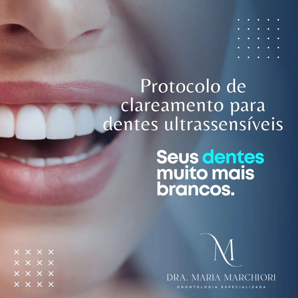 Clareamento Dental Ribeirão Preto