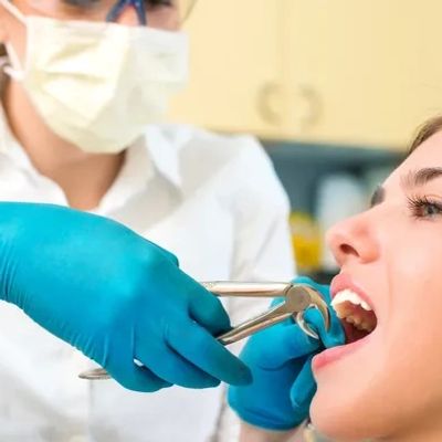 TOOTH EXTRACTION
