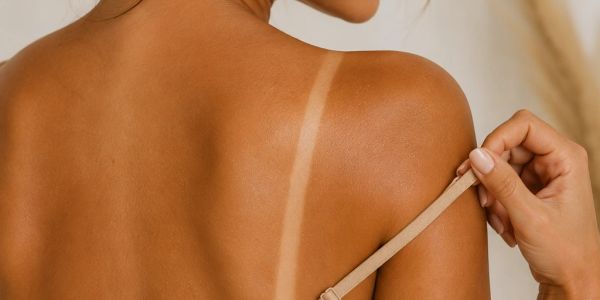 Close-up of a sun-kissed back with a visible tan line under a bra strap.
