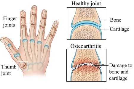 hand knuckle joints parts