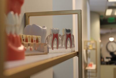 Dental anatomy models displayed on a shelf.