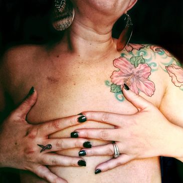 woman covering area where breasts had been before bi-lateral masectomy from breasst cancer