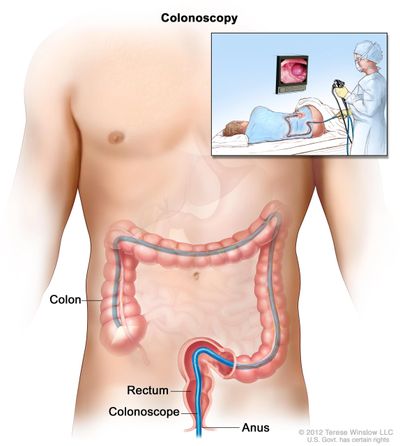 NYGE Colonoscopy Gastroenterologist Gi Doctor