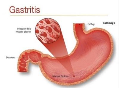 Endoscopia Colonoscopia EGD Gastroenterologo Gastrologist GI Doctor Gastroenterologist