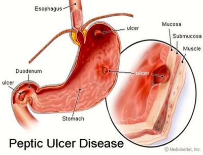 Endoscopia Colonoscopia EGD Gastroenterologo Gastrologist GI Doctor Gastroenterologist