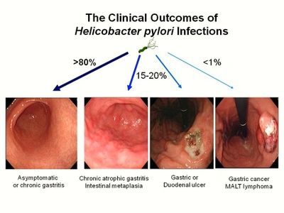 Endoscopia Colonoscopia EGD Gastroenterologo Gastrologist GI Doctor Gastroenterologist