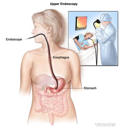 Endoscopia Colonoscopia EGD Gastroenterologo Gastrologist GI Doctor Gastroenterologist