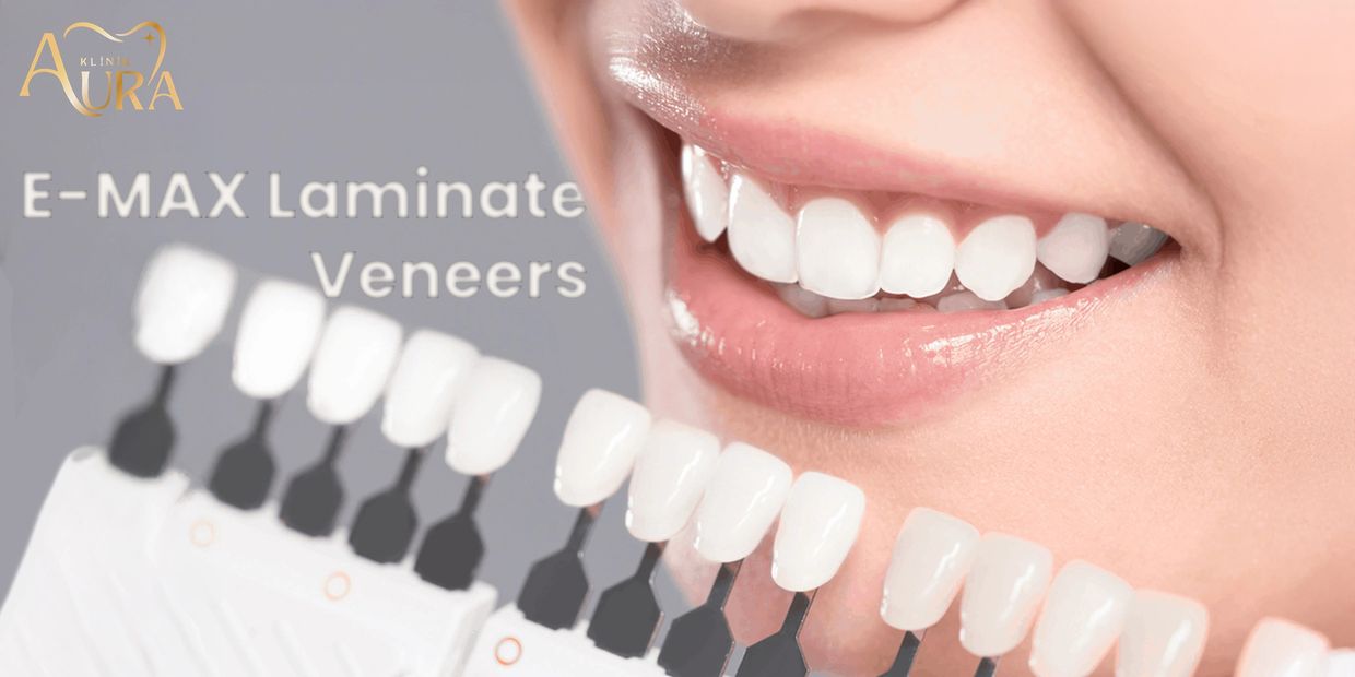 
3D smile design 

Ultra-thin ceramic laminates (minimal prep) 
EMAX Laminate Veneers

