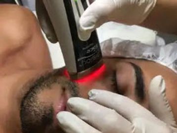 Sisloy Rejuvenation Facial Radiofrequency