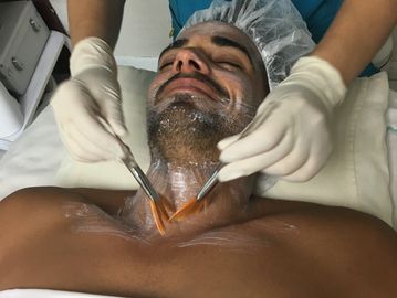 Chemical Peel in Miami River Landing Mall