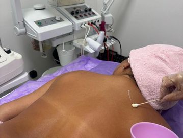 Back Facial Pelling in Miami River Landing Mall