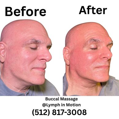 Before and after first session