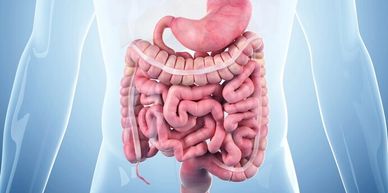 small bowel obstruction symptoms