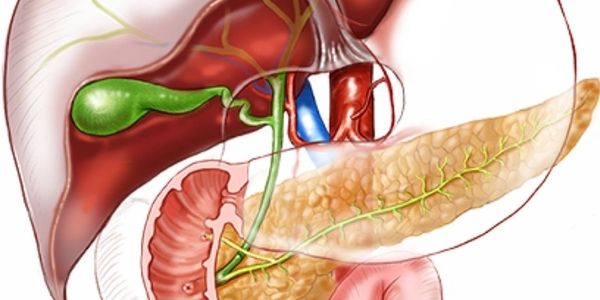 gallstone pancreatitis,
biliary pancreatitis symptoms,
biliary pancreatitis treatment,
ERCP
