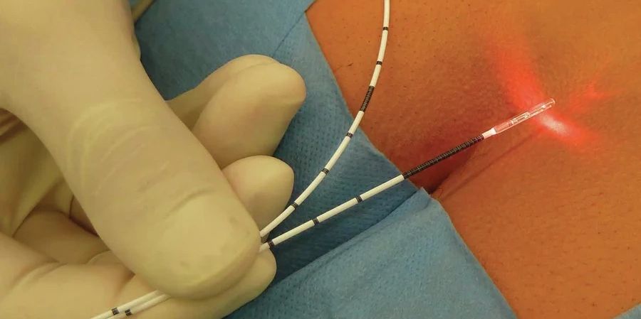 laser surgeon in Mumbai
