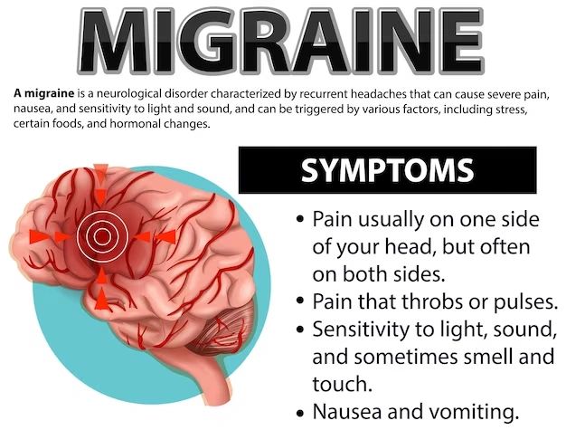 tobacco headache cure How to Treat Migraine Headaches Without Medicine