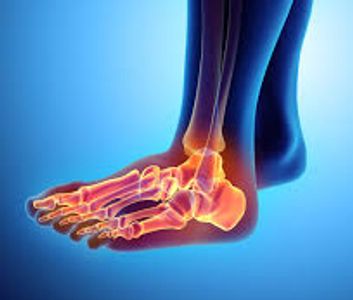 An anatomical image of a foot highlighted in red showcasing pain or irritation