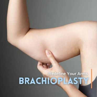 Before and After Arm Surgery Comparison.