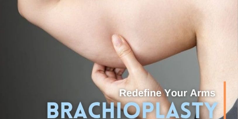 Brachioplasty & Thigh Lift Surgery in Tijuana