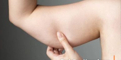 Brachioplasty and thigh lift surgery in Tijuana to remove excess skin and reshape the upper arms and