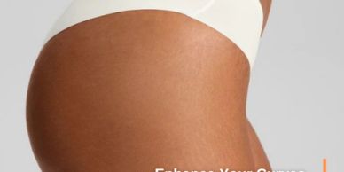 Brazilian Butt Lift in Tijuana with upper and lower back liposuction and fat transfer to the buttock