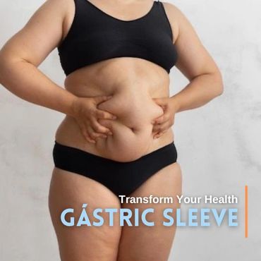 Gastric Sleeve Surgery in Tijuana for Effective Weight Loss.