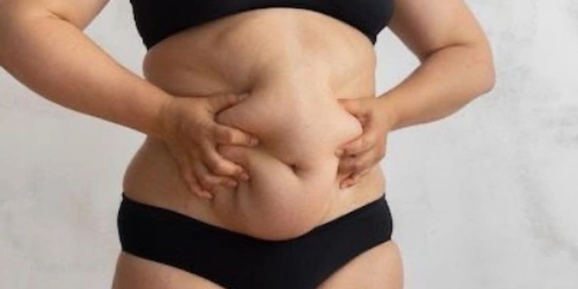 Gastric Sleeve & Gastric Bypass in Tijuana