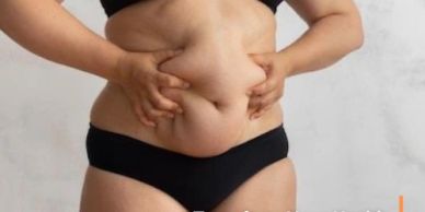 Gastric sleeve and gastric bypass surgery in Tijuana, Mexico, for surgical weight loss and metabolic